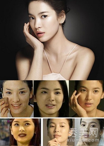 韩国娱乐圈丑女大翻身 看谁整容最成功？
