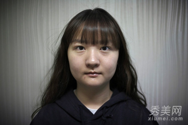韩国“人造美女”大赛 5位选手整容手术过程