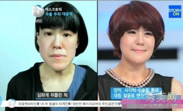 图揭韩国人造美女 丑女变美整容前后