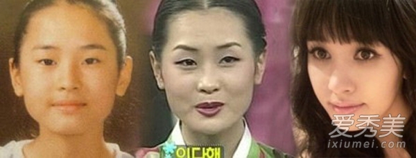 韩女星整容上瘾 韩智敏黄静茵朴敏英脸畸形