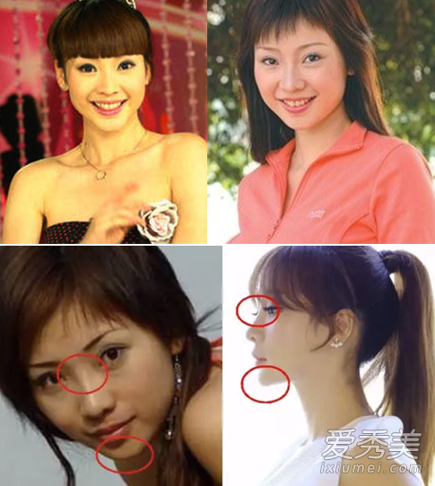 不整容不是好演员！柳岩张天爱容貌变化惊人 女明星整容前后