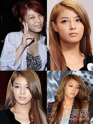 韩国女星整容也无用 素颜皮肤差眼睛小