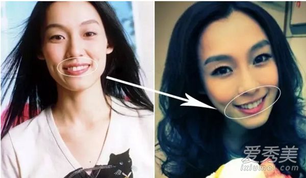 沈夢辰用繩命模仿Angelababy 嘴角上揚蜜汁尷尬 沈夢辰整容