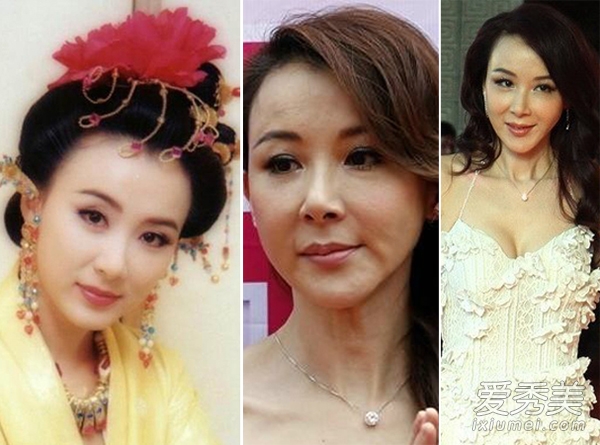 杨子姗霍建华小S萧蔷 鼻子歪天生or整容？