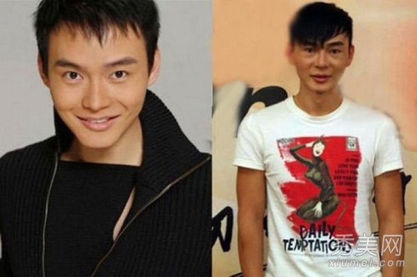 明星爱美整容失败 轻者毁容重者丧命