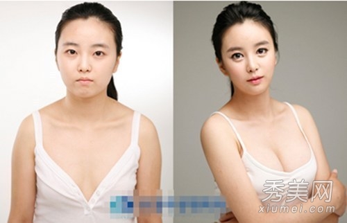 太神奇！韩国丑女整容前后惊人对比
