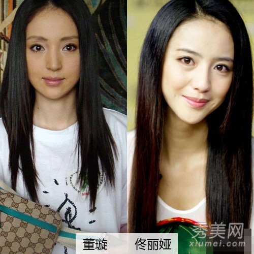 女星整容集体撞脸 大S暗讽张雨绮整容