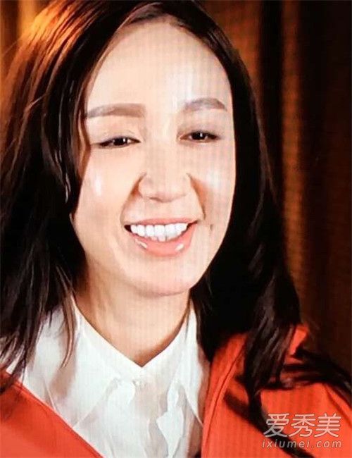 娄艺潇脸僵舒畅下巴变尖 明明很好看了干嘛还要整呢？ 女明星整容前后照片