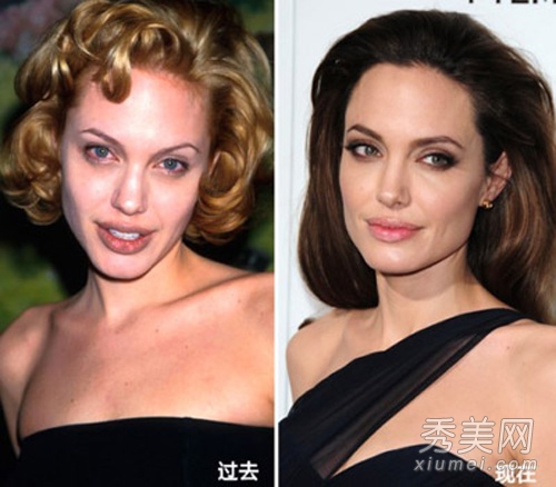 圖揭8大好萊塢女星 微整形後越老越美