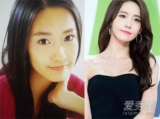 林允儿被曝从头整到脚 肚脐和腿都不放过 林允儿整容前后