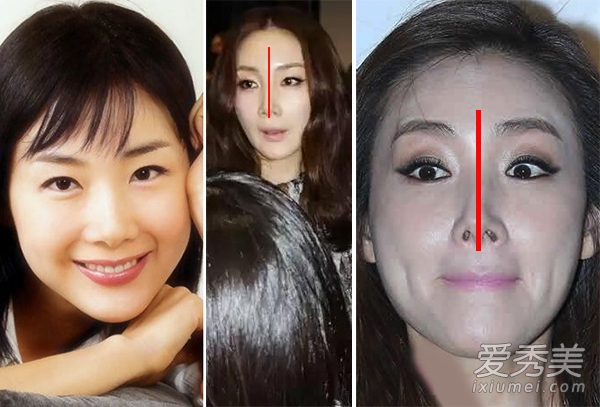 杨子姗霍建华小S萧蔷 鼻子歪天生or整容？