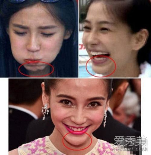 怀孕后的baby越来越美 都说女大18变她这简直是72变啊！ angelababy整容前后照片