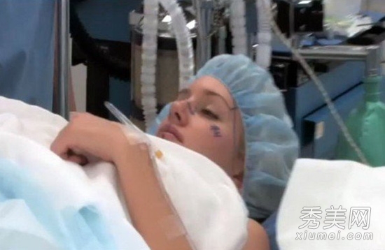 美国女星1天10整容手术 整容过程图片