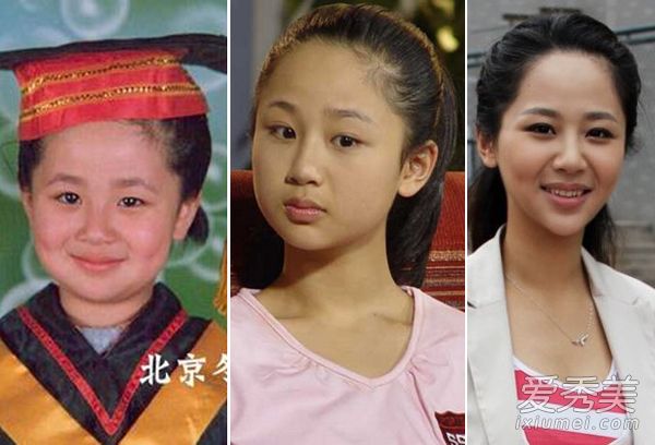 杨紫的脸怎么了？当年圆脸黑妞变“撞脸王” 杨紫整容前后