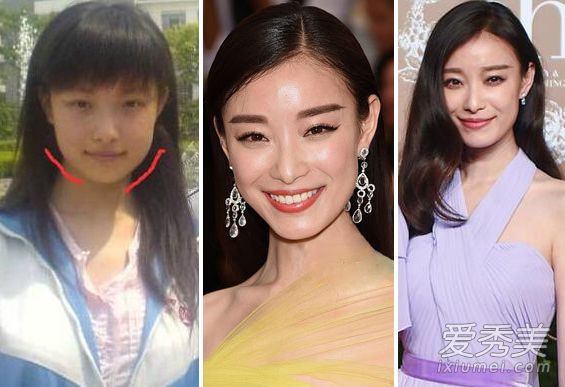 冯绍峰眼光变差了！林允绿豆眼蒜头鼻不及倪妮 林允旧照有点丑