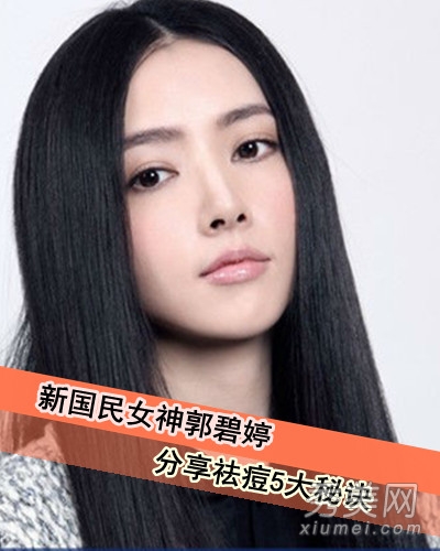 “国民女神”郭碧婷 瓷白美肌5大祛痘秘笈