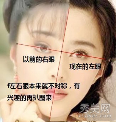 网友图揭范冰冰整容真相 开眼角改脸型真假