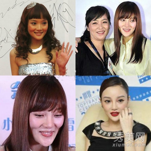 李小璐霍思燕秦岚领衔“姐妹团”拼美颜 明星整容前后对比照