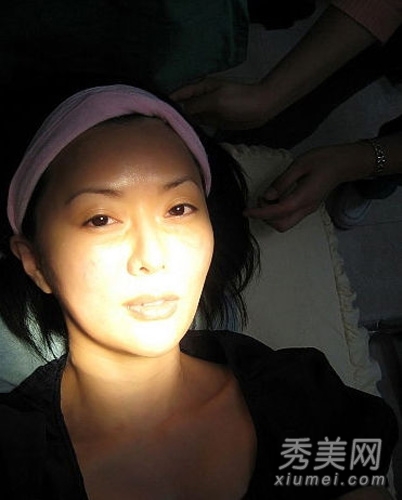 40歲TVB藝人陳莉敏 30次整容過程圖