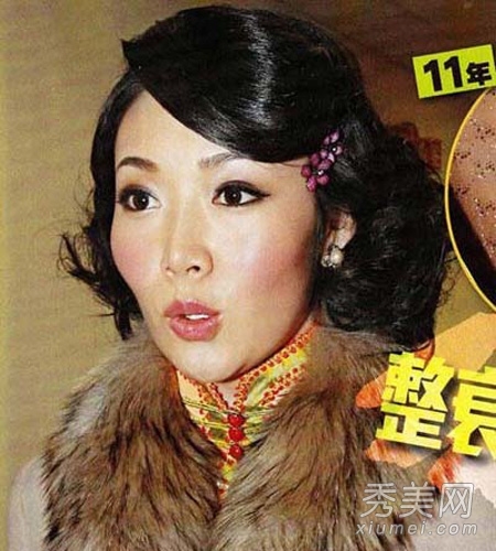 赵薇老公前女友 1年64针瘦脸针变僵尸脸