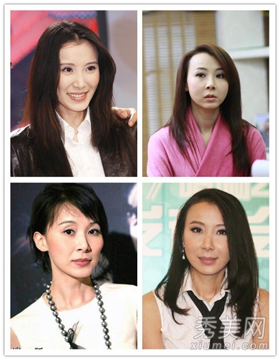 中国恐龙女变白肤美 女星整容前后对比照