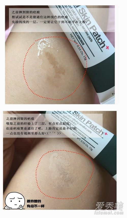 韩国not4u液态隐形胶布怎么样 real skin patch液态隐形胶布多少钱