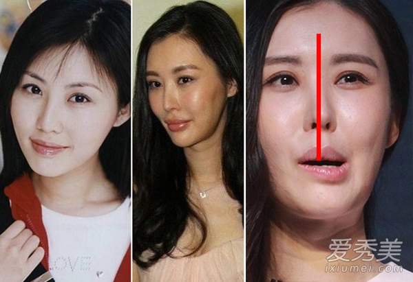 杨子姗霍建华小S萧蔷 鼻子歪天生or整容？