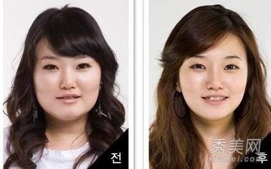 整形全纪录：韩国女人整容前后（图）