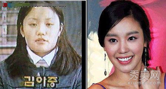 韩国女星整容成瘾 二次整容失败脸变残