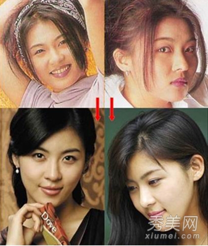 史上最全40位韩国女星 整容对比大全（二）