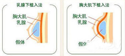 技術貼：全方位分析楊冪到底整了哪裏？ 楊冪整容前後照片