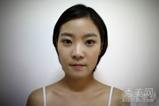 5位韓國整形模特 血腥整容手術高清圖