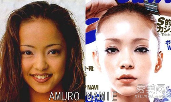 日本明星整容前後：男割雙眼皮+女隆鼻改臉型整容失敗的日本明星