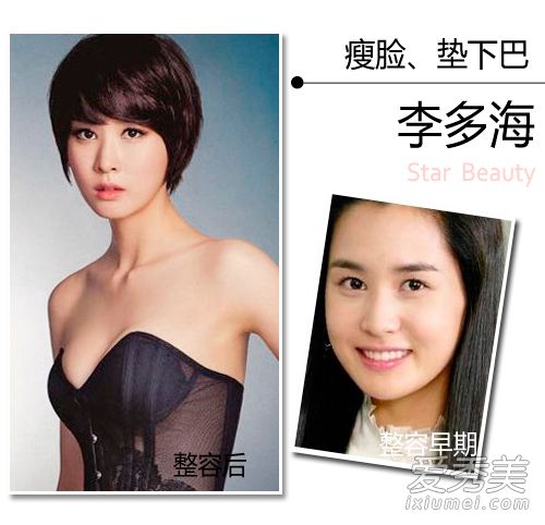 美女的诞生靠整容？韩国女星整容位置大揭秘 明星整容前后照片对比