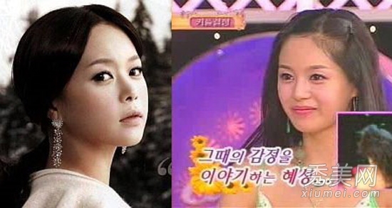 韩国女星整容对比照 二次整容修正失败