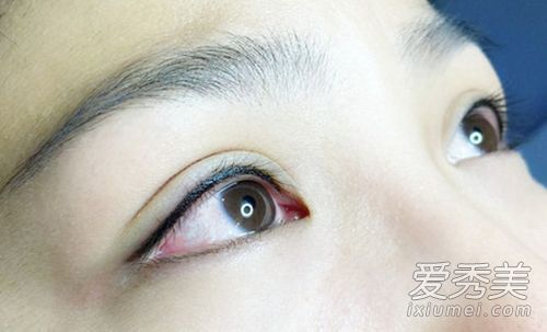 真是太可怕了！“韩式美瞳线”的危害居然那么大 美瞳线的危害