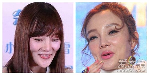 冯小刚新剧选角说整过容的免谈 那这些女星铁定没戏！ 整过容的女明星