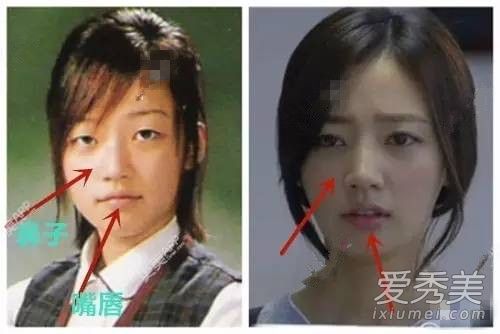 说好的零整容又让你们失望了！黄轩女友换脸史惊人 整过容的女明星