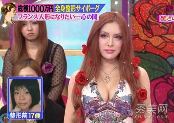 日本少女整容變“芭比” 63萬30次整容（圖）