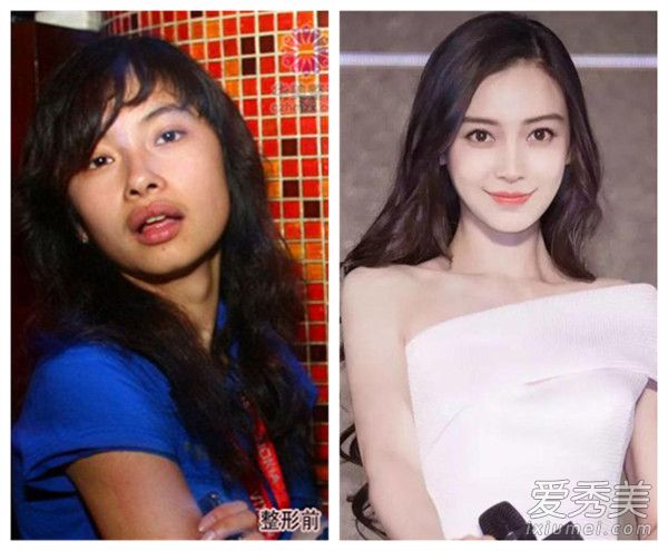 冯小刚新剧选角说整过容的免谈 那这些女星铁定没戏！ 整过容的女明星