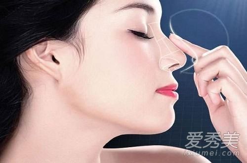 线雕隆鼻露线怎么办 线雕隆鼻露线能减掉吗