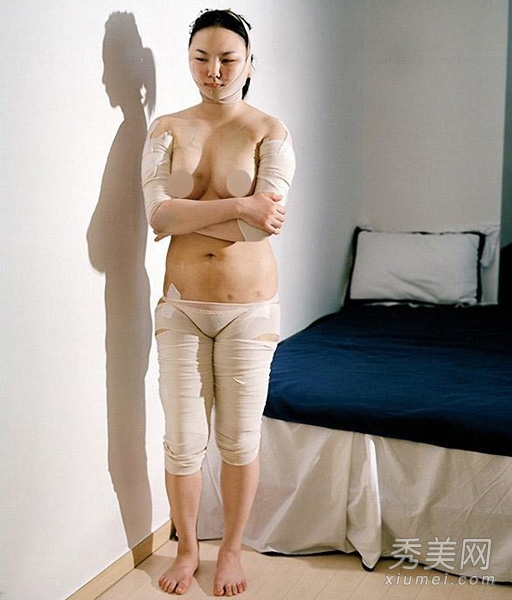 摄影师跟拍：韩国女子整容手术后恐怖模样