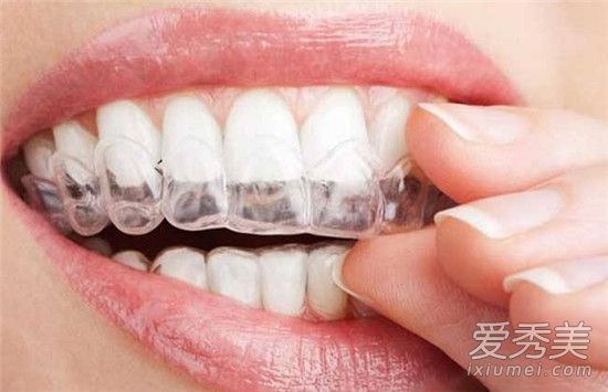 牙齿黄如何变白 牙齿黄是什么原因
