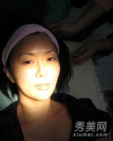 40岁落选港姐 陈莉敏公开整容手术图