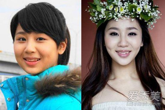 不整容不是好演员！柳岩张天爱容貌变化惊人 女明星整容前后