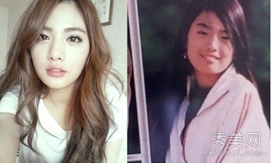 韓國第一美女 Nana整容前後對比照