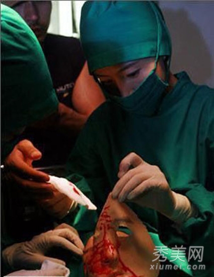 韩国整容手术内幕 实拍血腥手术过程