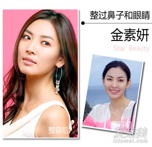 美女的誕生靠整容？韓國女星整容位置大揭秘 明星整容前後照片對比