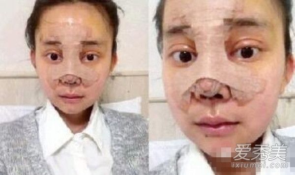 吴玉青花百万整成angelababy，可baby也是整的啊！ 整成baby的女孩图片