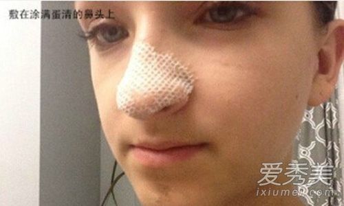 史上最强去黑头 手把手亲测有效 去黑头最有效的方法